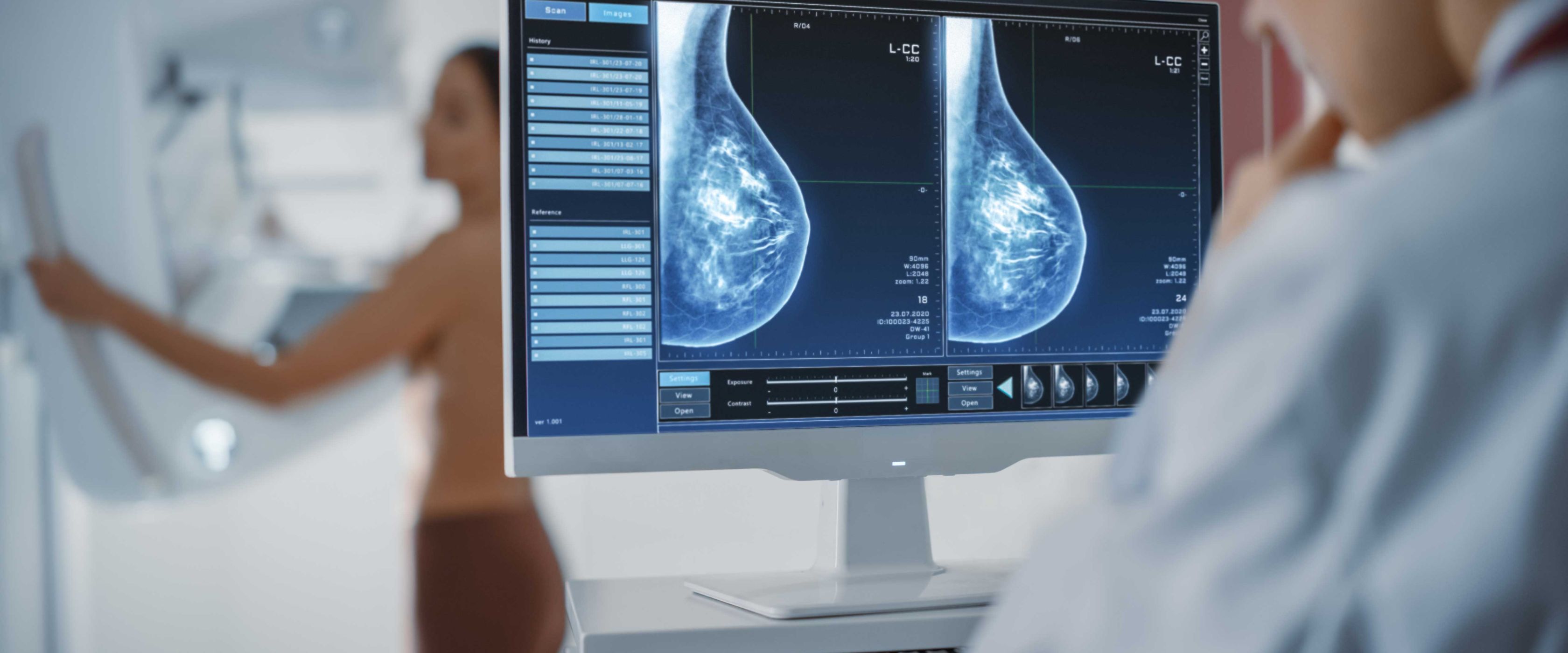 Mammogram Tech